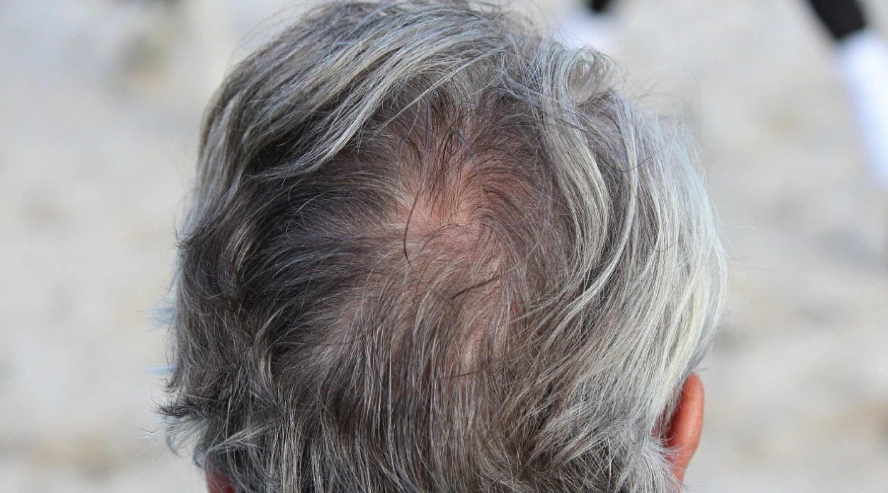 Haare mit 50 graue Graue Haare