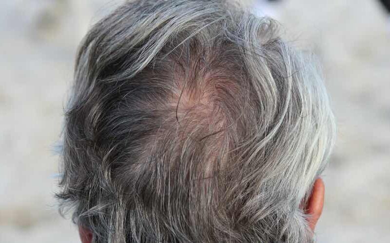 Graue Haare beim Mann – Kein Grund zur Panik 