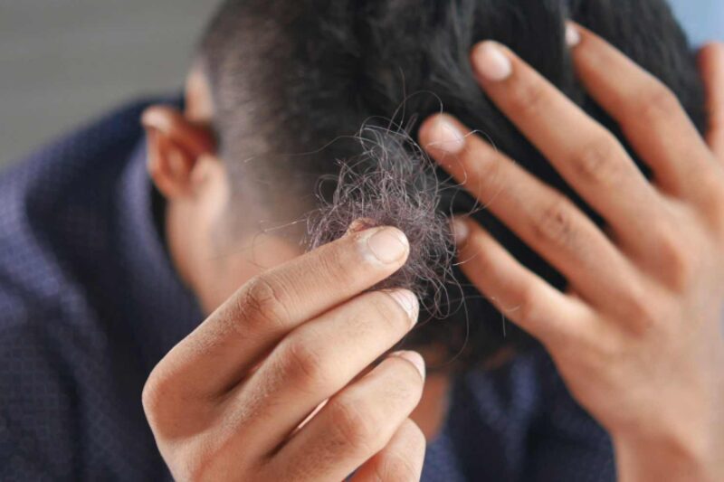 Haarwuchsmittel – was hilft wirklich gegen Haarausfall?
