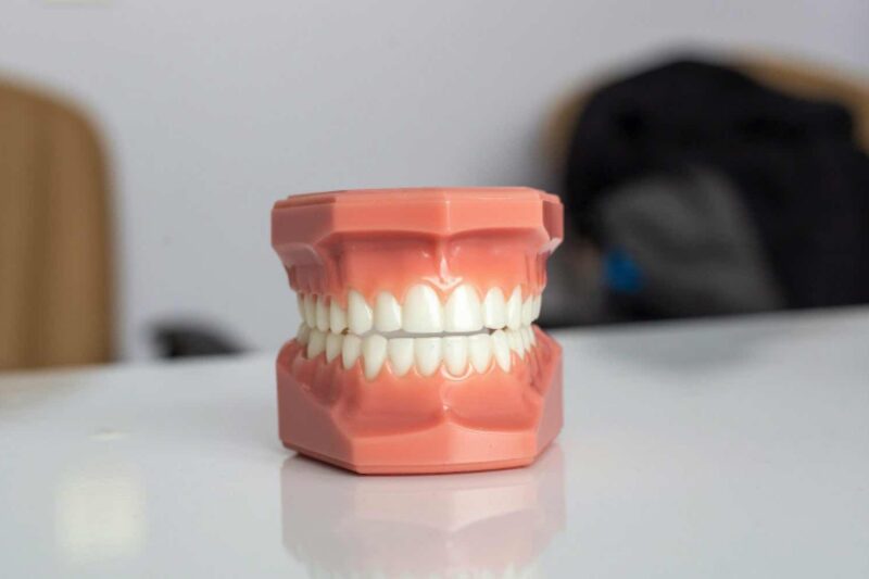 Veneers oder Kronen, smile like a king!